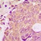 Anti-Beta-arrestin-1 Antibody
